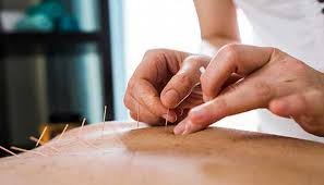 Healing Power Chinese Acupuncture