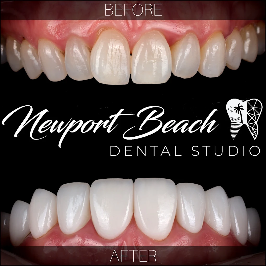 Newport Beach Dental Studio | Dr. Tai Ha, DDS