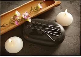 Palmdale Acupuncture Wellness