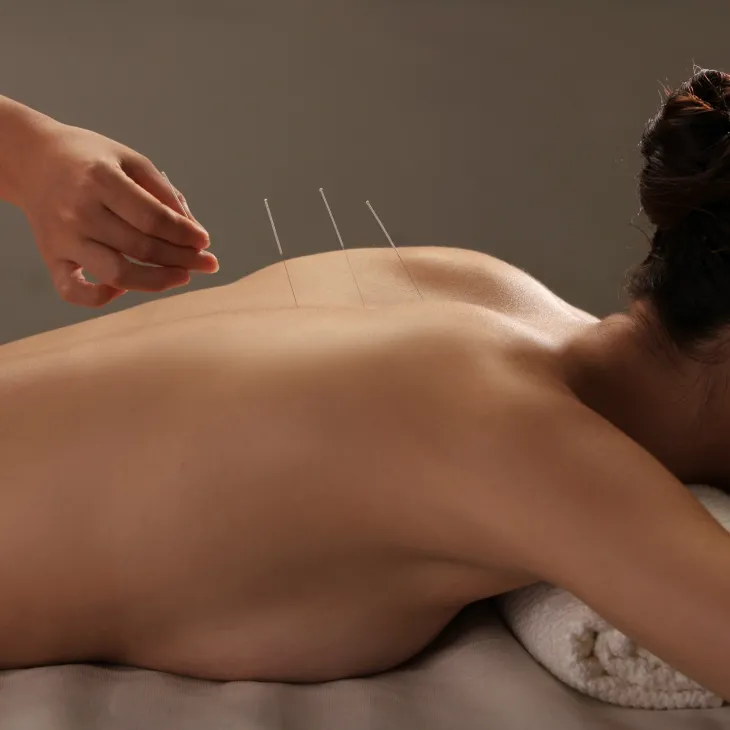Acupuncture Help Center- Dr.Mehrdad Joukar M.D.(Iran),DAOM,L.Ac.