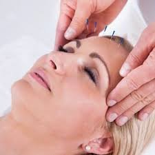 Acupuncture Help Center- Dr.Mehrdad Joukar M.D.(Iran),DAOM,L.Ac.