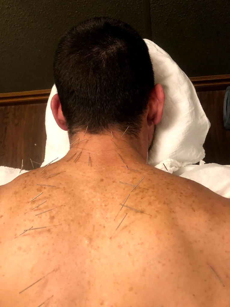 Redlands Family Acupuncture