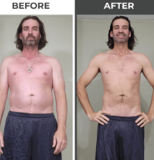 Weight Loss Center of San Diego