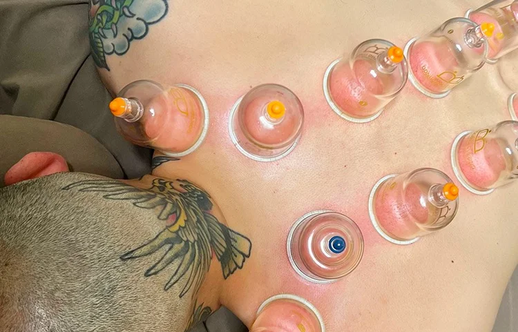 San Francisco Community Acupuncture